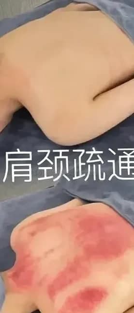 伊琳 · 第一次試呢種比較私密嘅調理，難免會緊張 (1)